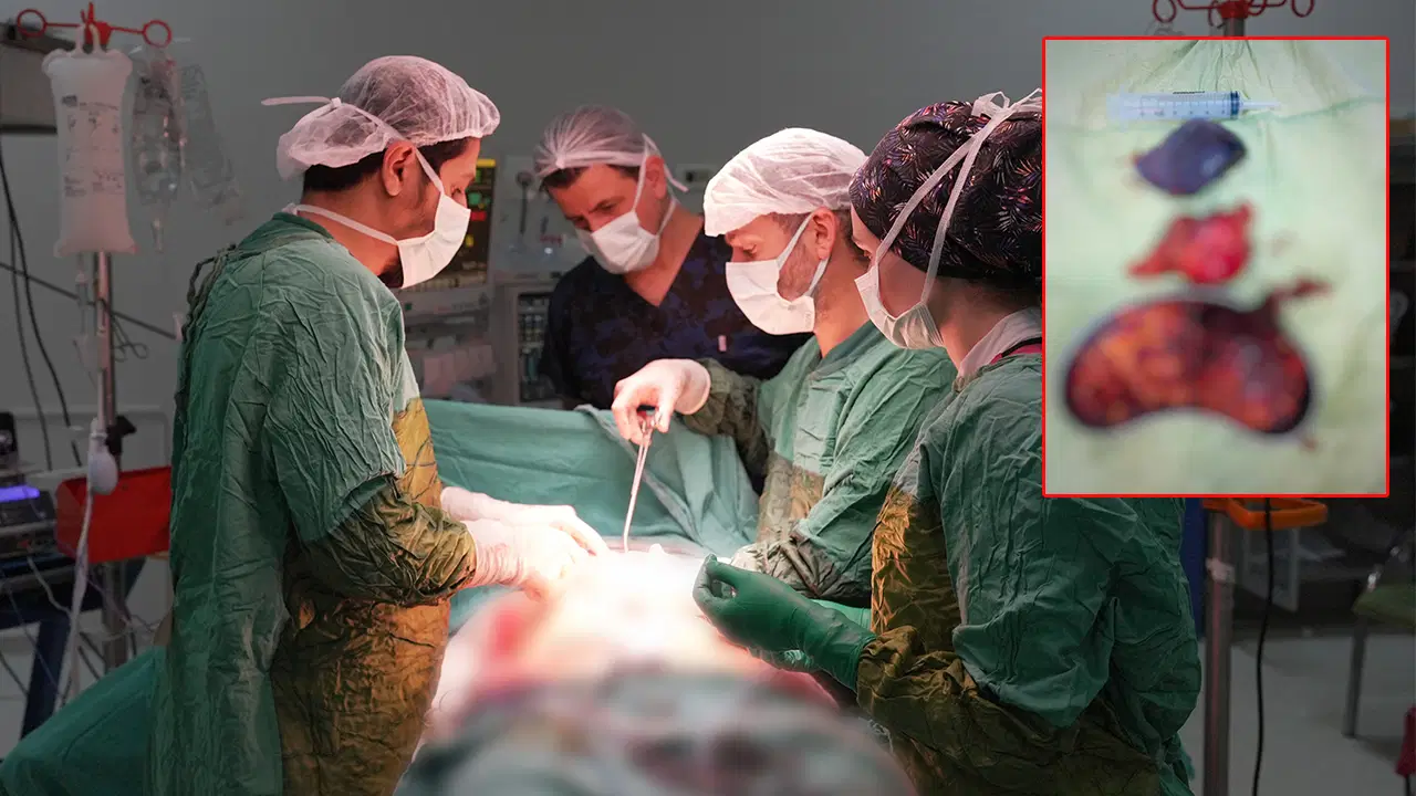Karnından 2 kilo 200 gram ağırlığında tümör çıkarıldı