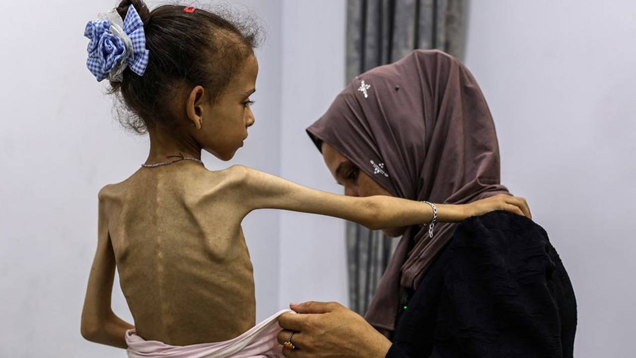 Yarım milyondan fazla Gazzeli açlıktan ölmek üzere!