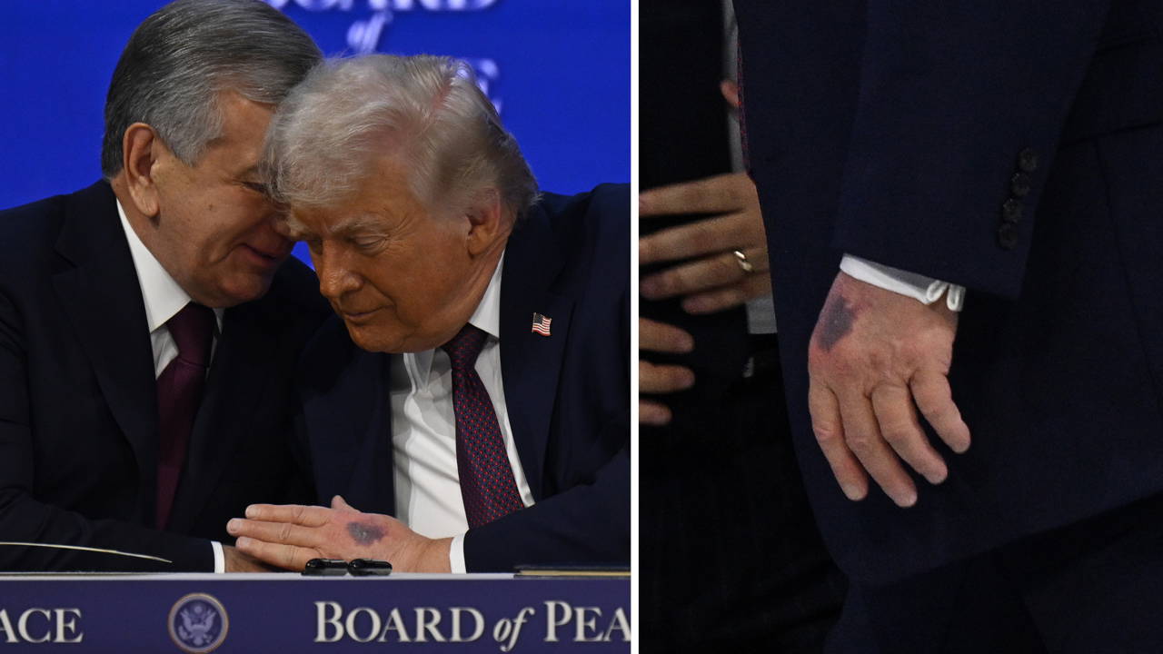 Sosyal medyada gündem olmuştu