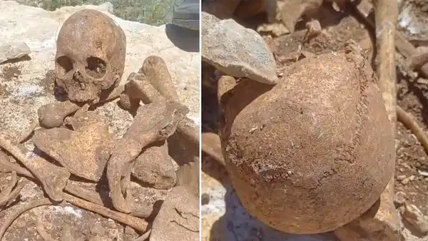 Malatya'da şaşırtan olay: İnşaat kazısında insan kemikleri bulundu