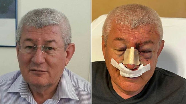 Uşak'ta SOL Parti İl Sözcüsü'ne saldırı 