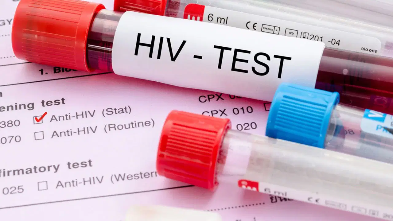 Kadıköy'de ücretsiz anonim HIV testi ve danışmanlık hizmeti 
