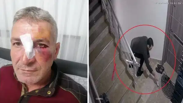 Dairesinin önüne hayvan dışkısı atan komşusundan, bu kez 'yüzüne kapı çarptığı' gerekçesiyle şikayetçi oldu