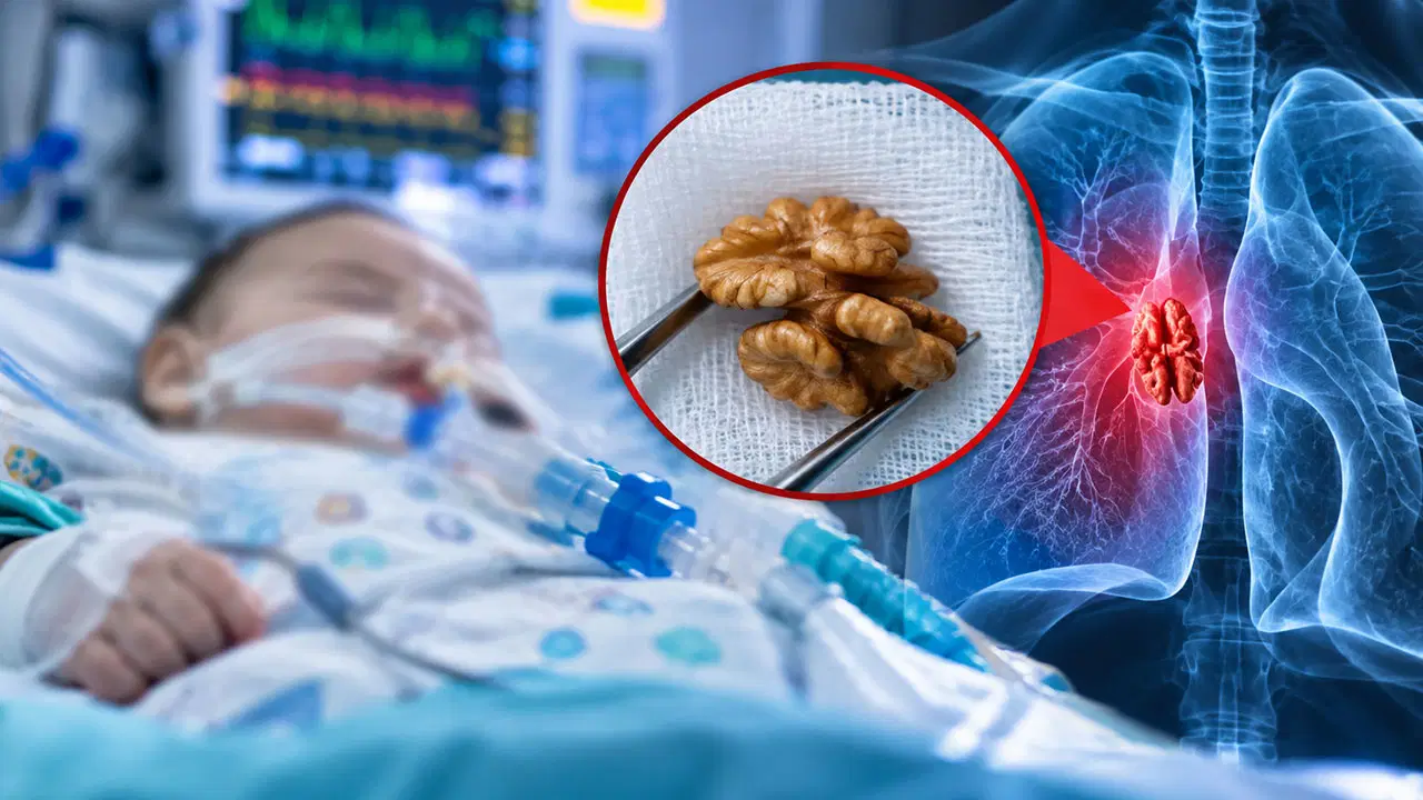 Doğum günü sonrası ölümden döndü: 1 yaşındaki bebeğin akciğerinden ceviz çıktı!