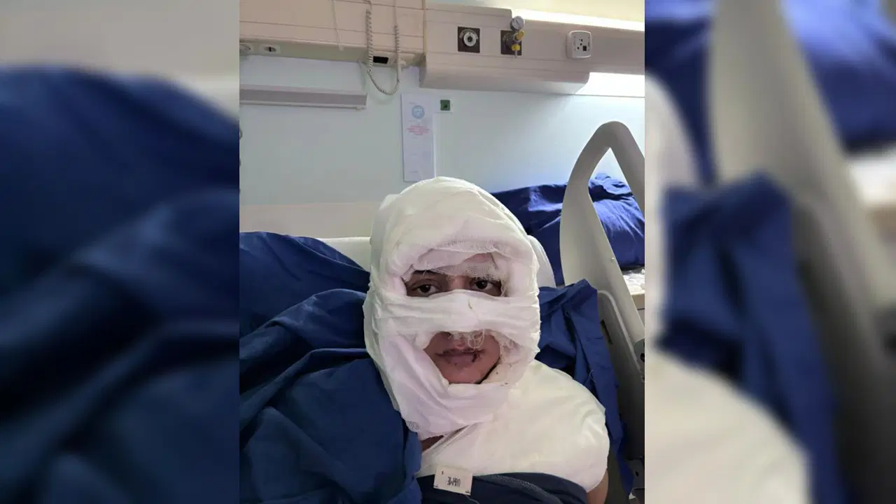 Kadıköy'de dehşet veren olay: Kadını yanıcı madde dökerek ateşe verdi!