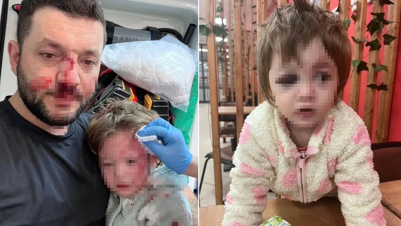 'Ses ve gürültüden' rahatsız olmuş: Komşunun saldırısında 14 aylık bebeğin kafatası çatladı!