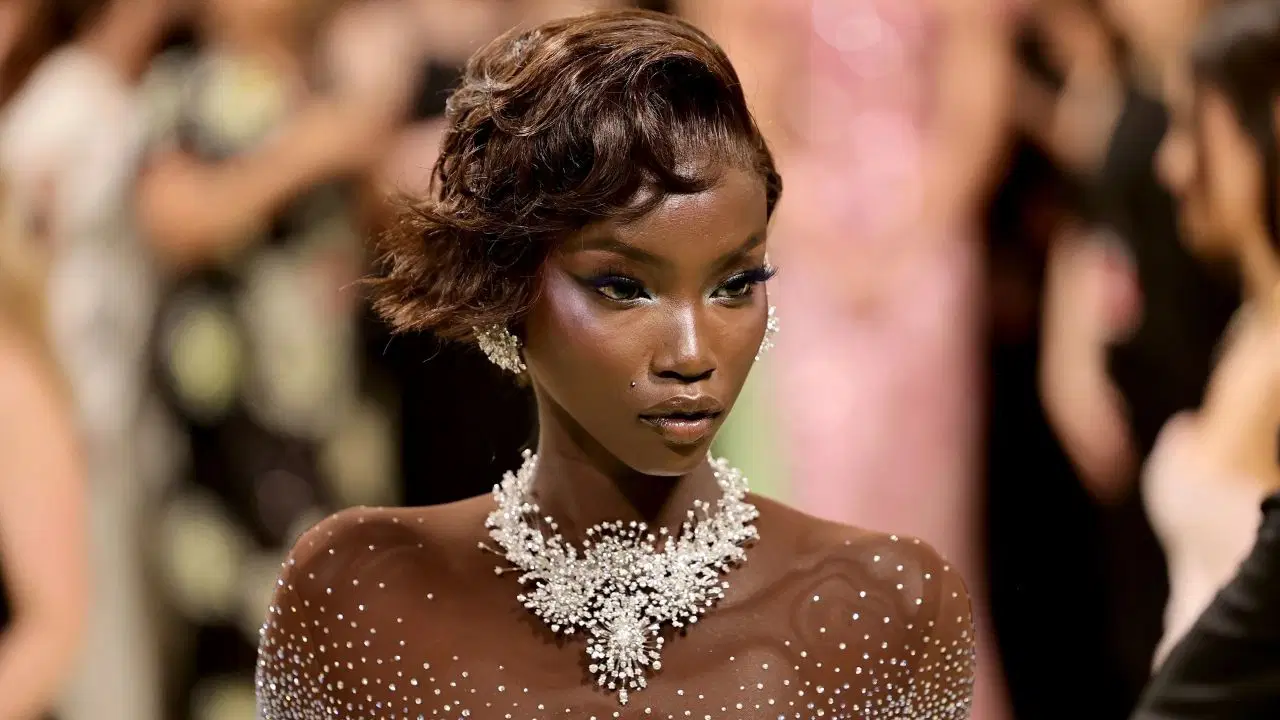 Ünlü model Anok Yai sessizce mücadele ettiği hastalığını açıkladı