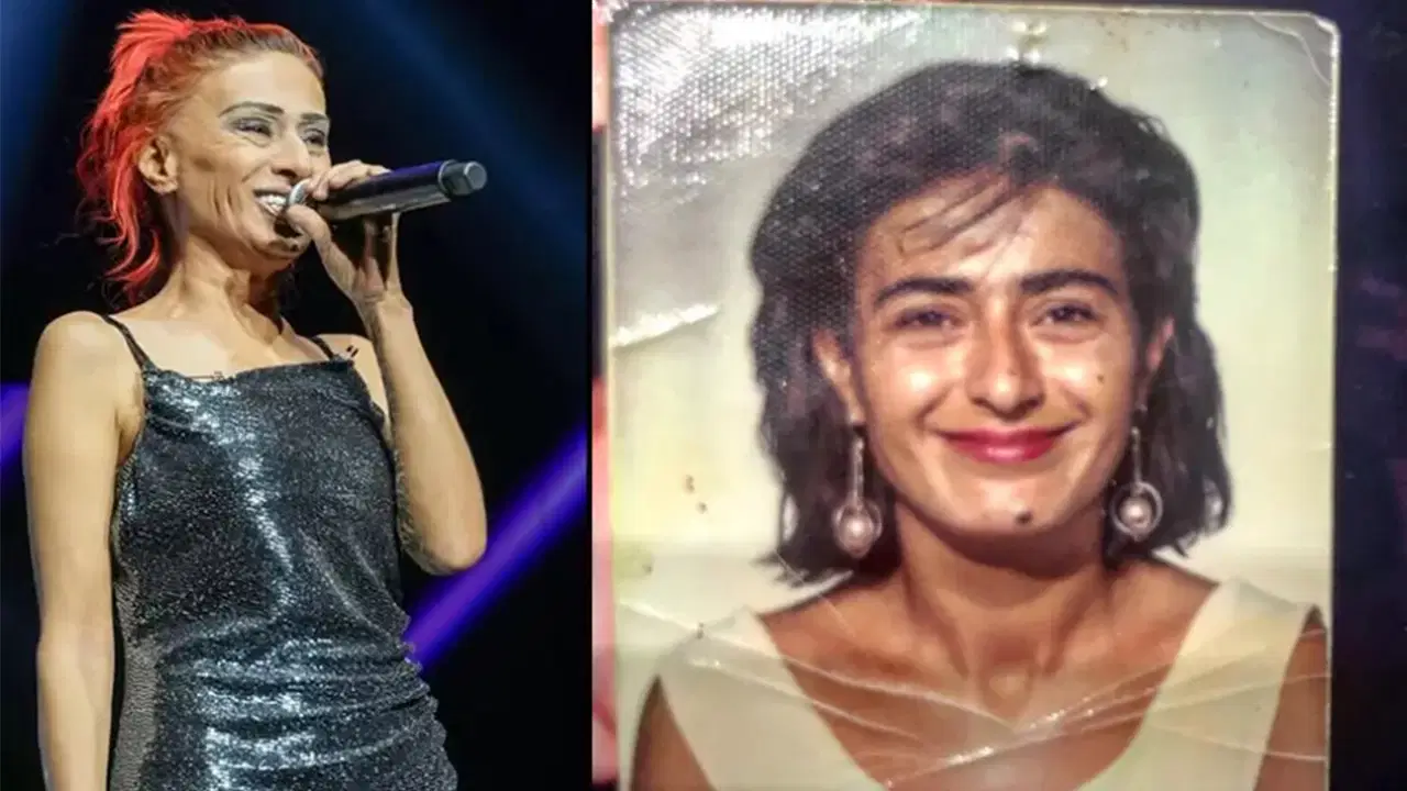 Yıldız Tilbe yıllar sonra yaşadığı kazayı anlattı: 'Sağ kulağımı çocukken kaybettim'