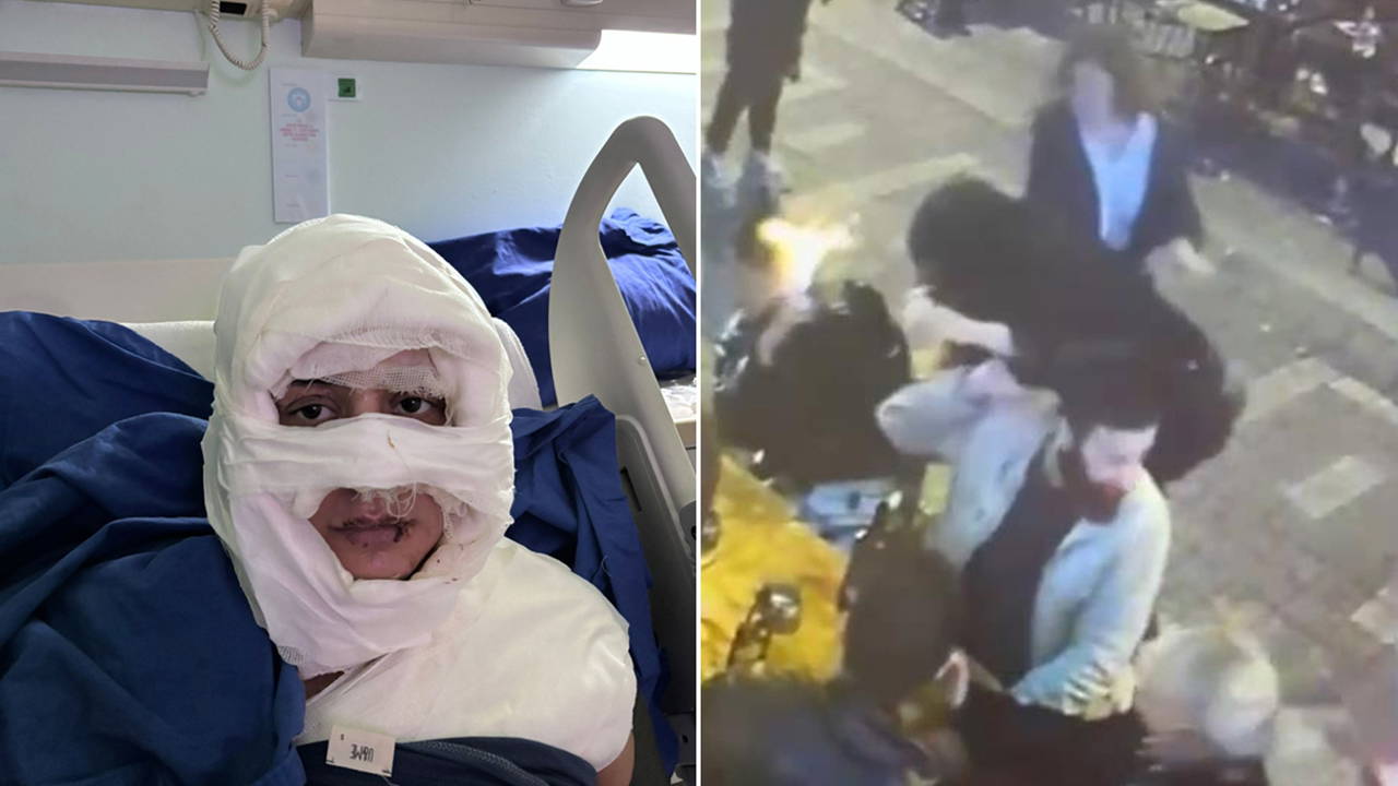 Kadıköy’deki 'kolonyalı saldırı' davasında pişkin savunma: 'Saçlarını yakmak istedim'