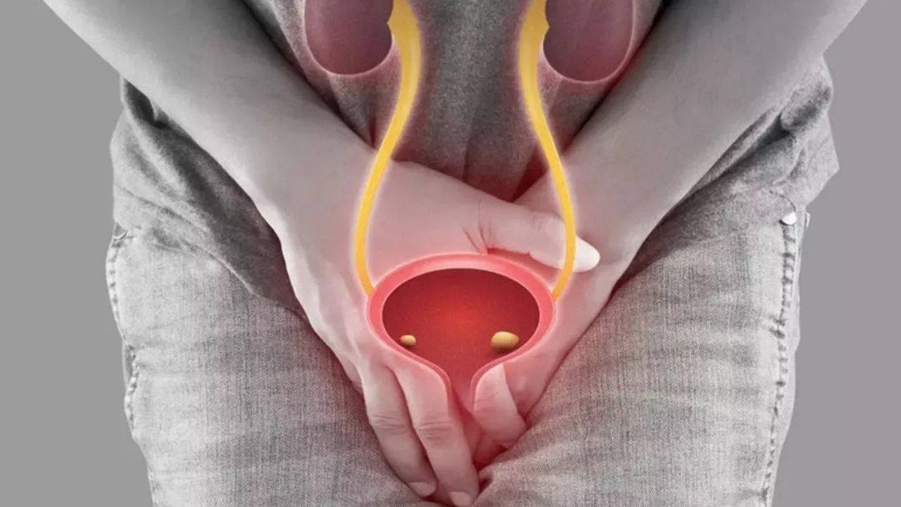 Uzmanlar açıkladı: Renk körlüğü mesane kanserinde ölüm riskini artırabilir