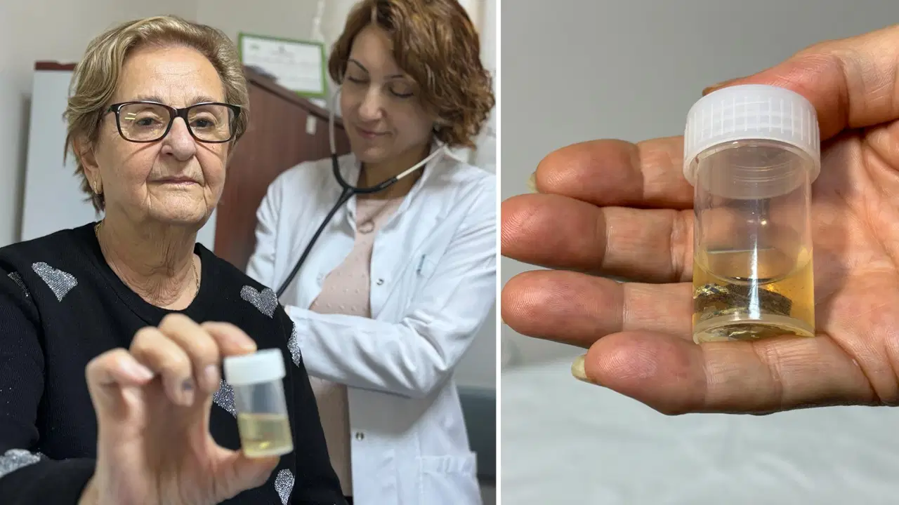 Hapı 'alüminyum kabıyla' yuttu: Akciğerinden 4 yıl sonra çıkarıldı