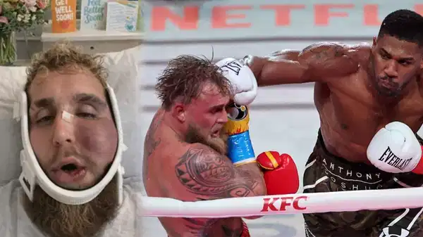 Yüzü tanınmaz hale geldi: Saniyede 4 milyon TL kazandı!