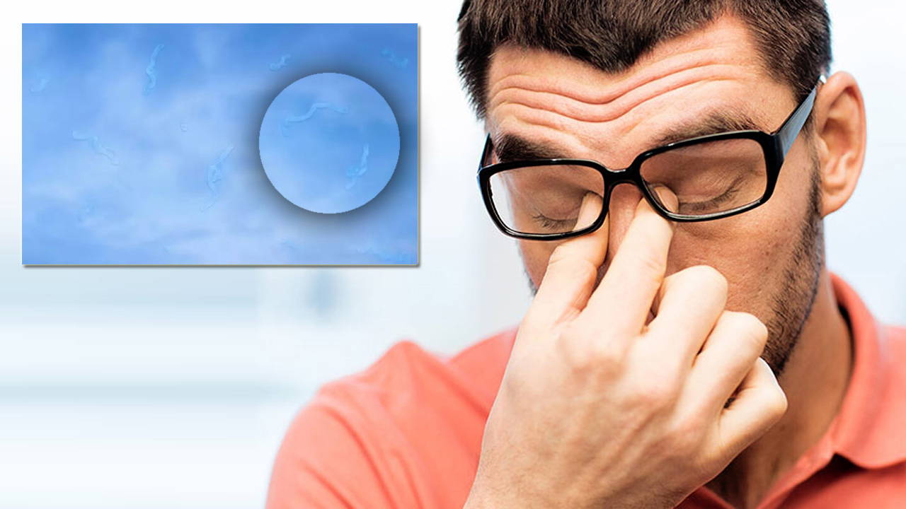 Görüş alanında 'uçuşan şekiller' görenler için acil uyarı