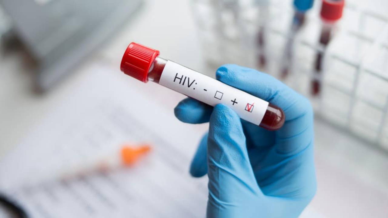 ‘Gelecek 10 yılda 7,7 milyon kişi HIV’den ölebilir’