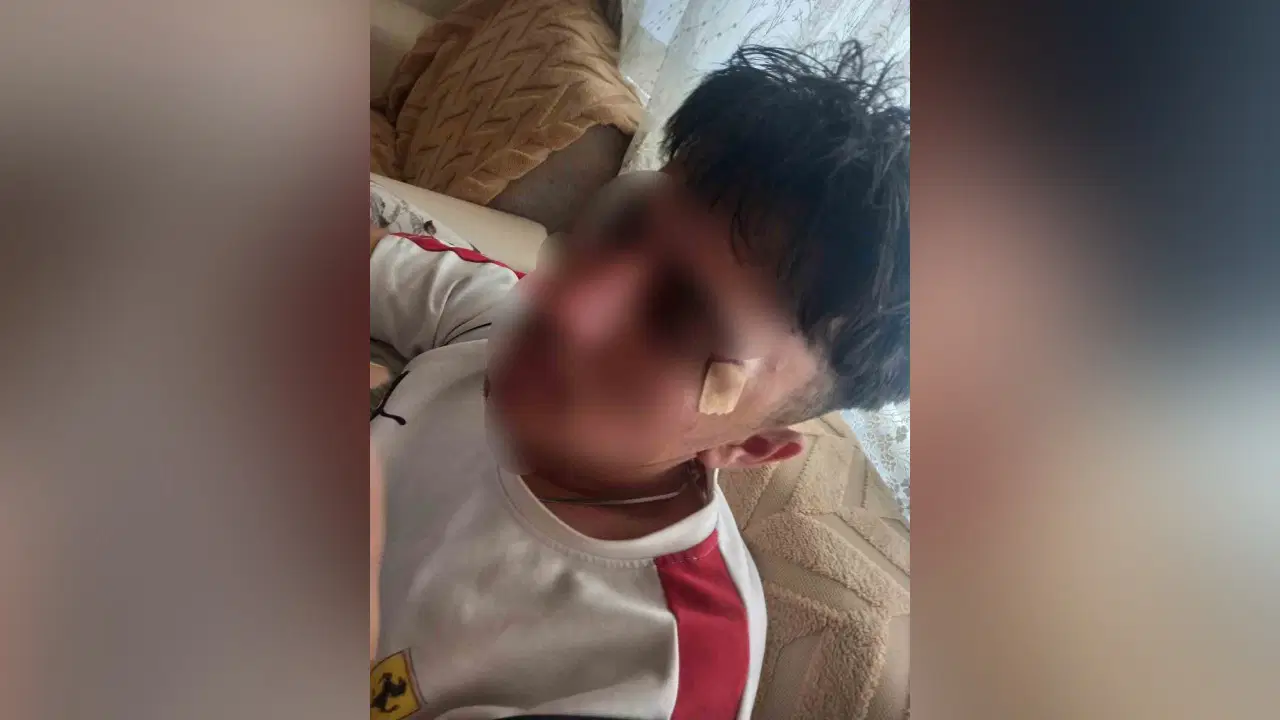 MESEM’de çocuğa şiddet: Öğrencinin burnunu kırdı