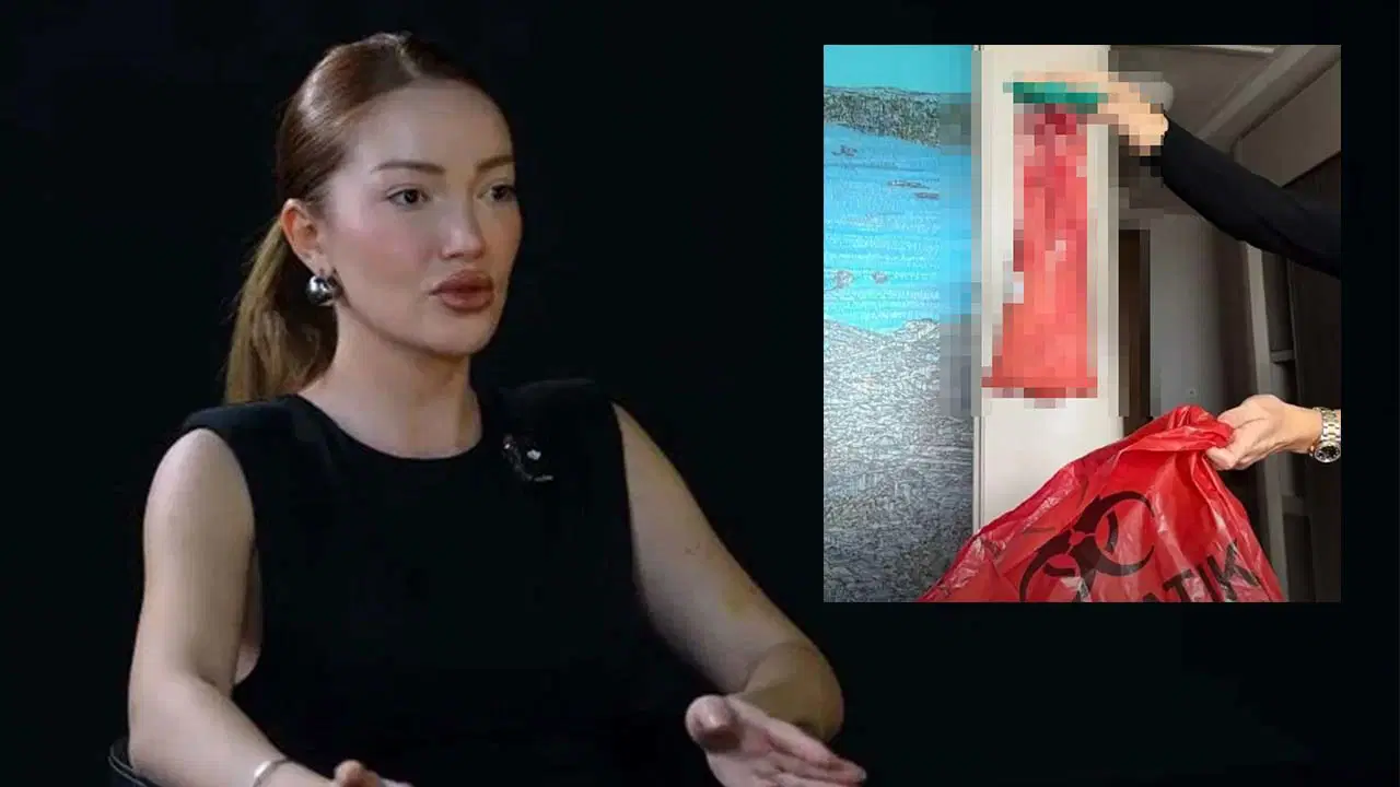 'Kalça dolgusu' uyarısı: Beşinci ameliyatından çıkan maddeyi paylaştı