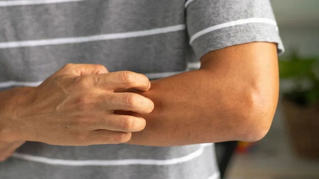 Onkologlar uyardı! Bu kaşıntı 4 farklı kanserin habercisi olabilir