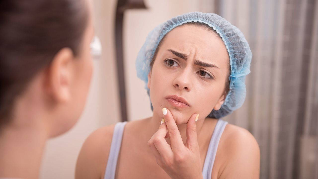 Diyet sivilceyi düzeltebilir mi, dermatologlar ne öneriyor?