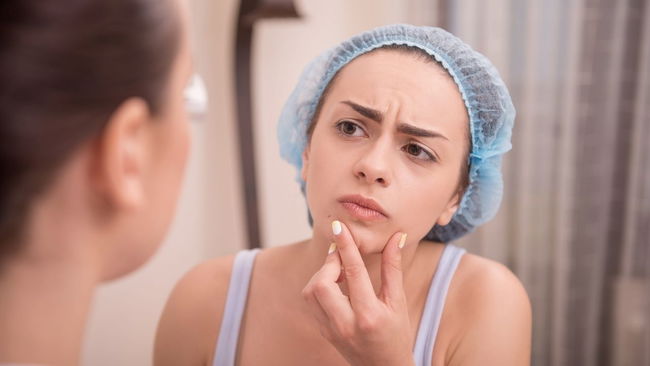 Diyet sivilceyi düzeltebilir mi, dermatologlar ne öneriyor?
