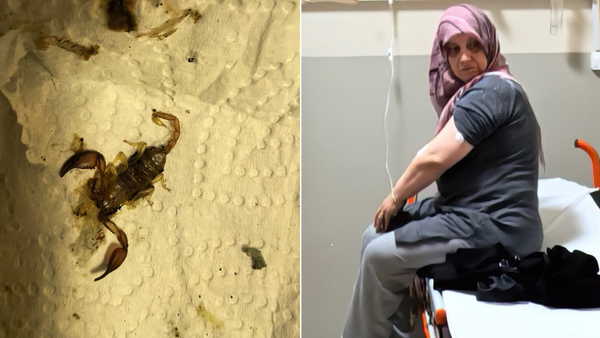 Odun taşırken akrep soktu, fenalaştı: 53 yaşındaki kadın hastanelik oldu