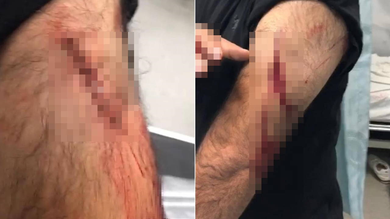 Şanlıurfa'da öğretmene sokak ortasında jiletli saldırı!