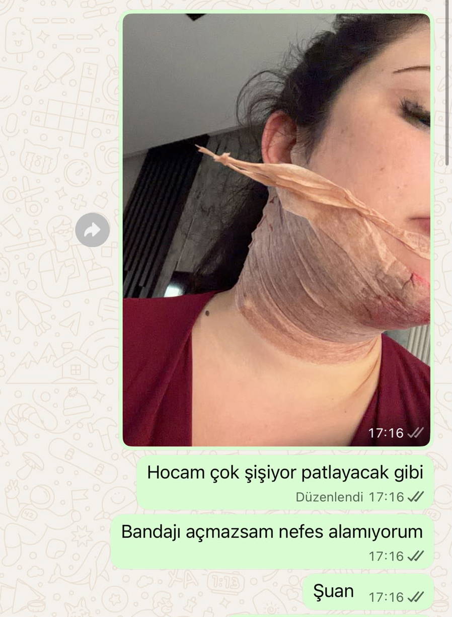 Galeri Görseli