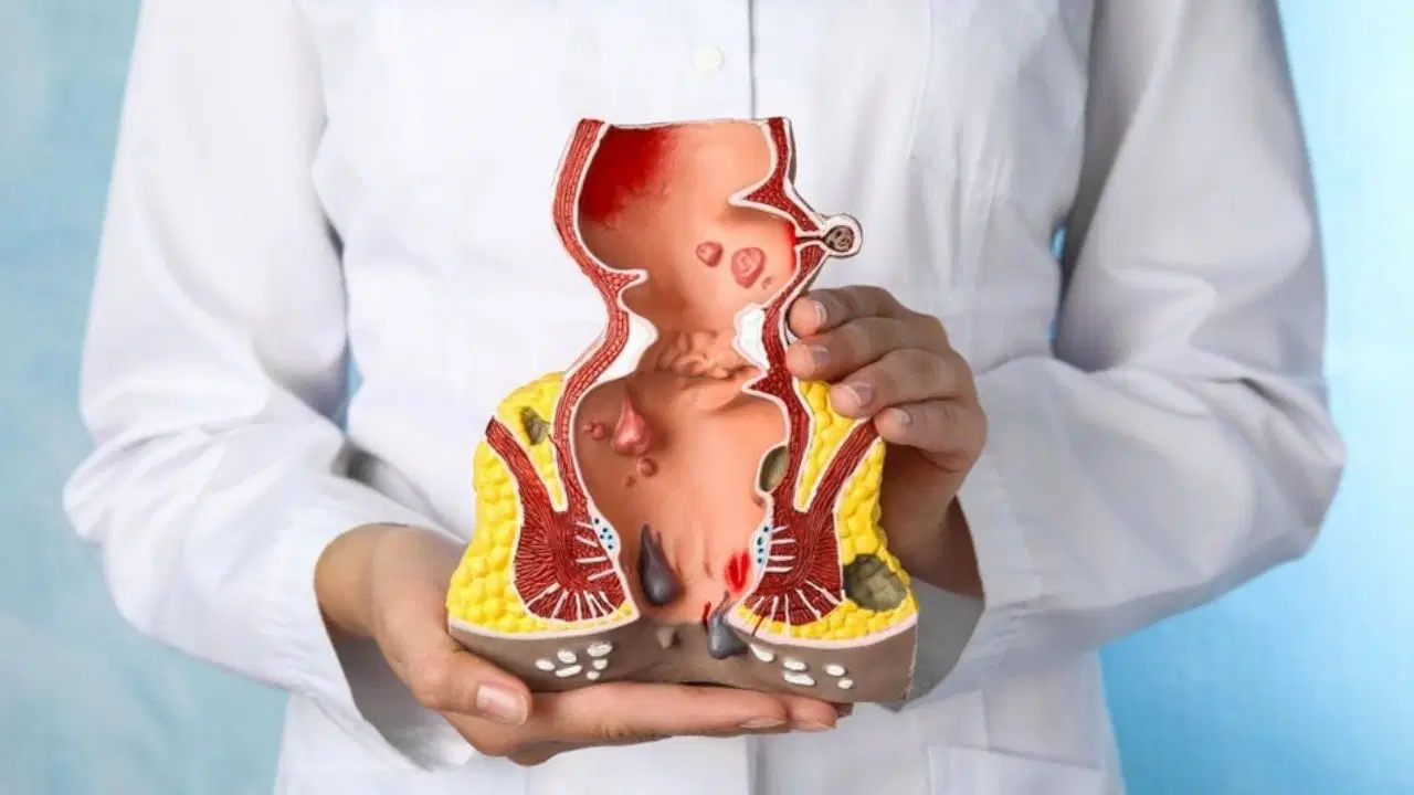 'Hemoroiddir' diyip geçmeyin: Vücudun en ciddi 'imdat' çağrısı olabilir! 