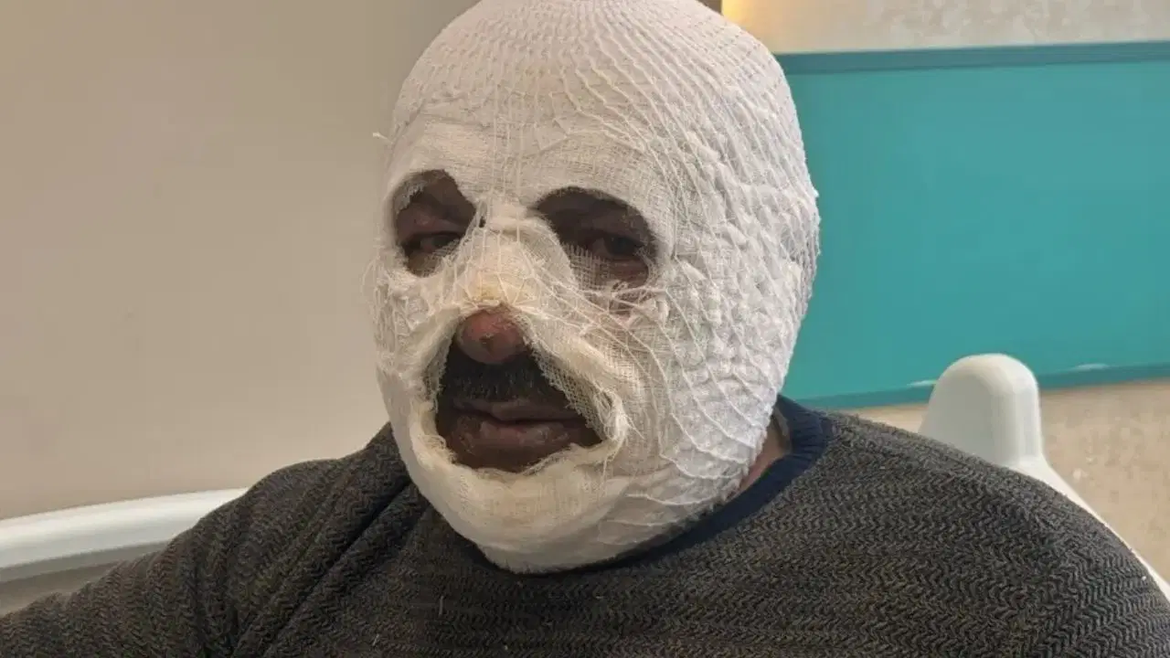 Kaloriferi yakmak isterken yandı: Madende feci kaza