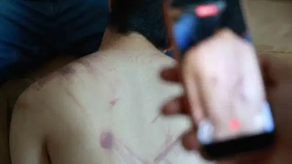 Elazığ'da rehabilitasyon merkezinde 'şiddet' iddiası: Adli ve idari soruşturma başlatıldı