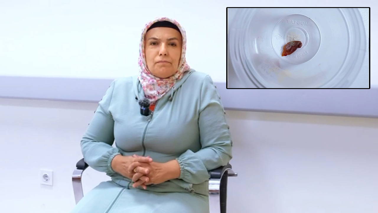 1,5 yıllık öksürüğün nedeni, kabak çekirdeği çıktı