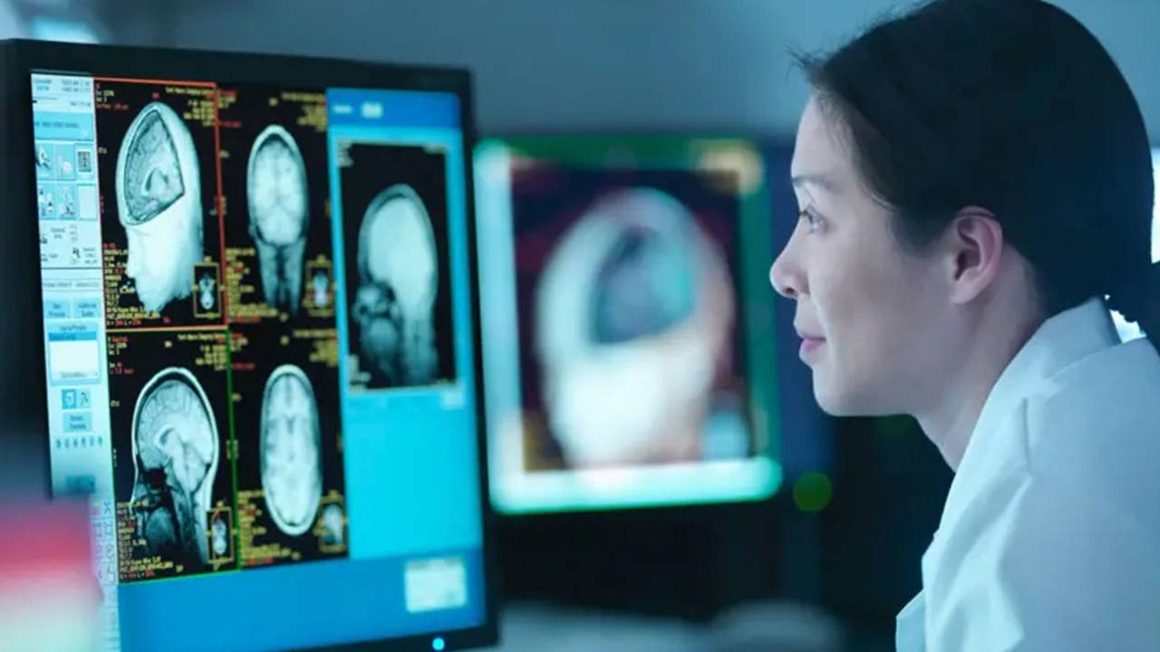 Menopoz beyni nasıl etkiliyor?