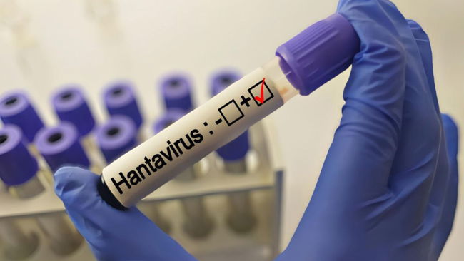 Grip ile karıştırılıyor: Uzmanlardan 'hantavirüs' açıklaması