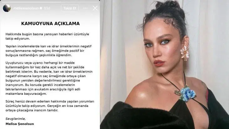 Galeri Görseli