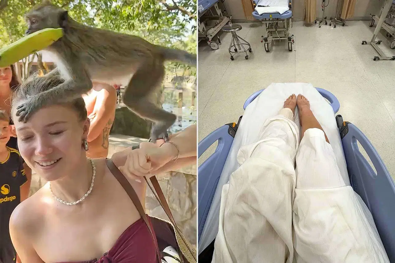 Sosyal medya fenomeni, maymun saldırısına uğradı