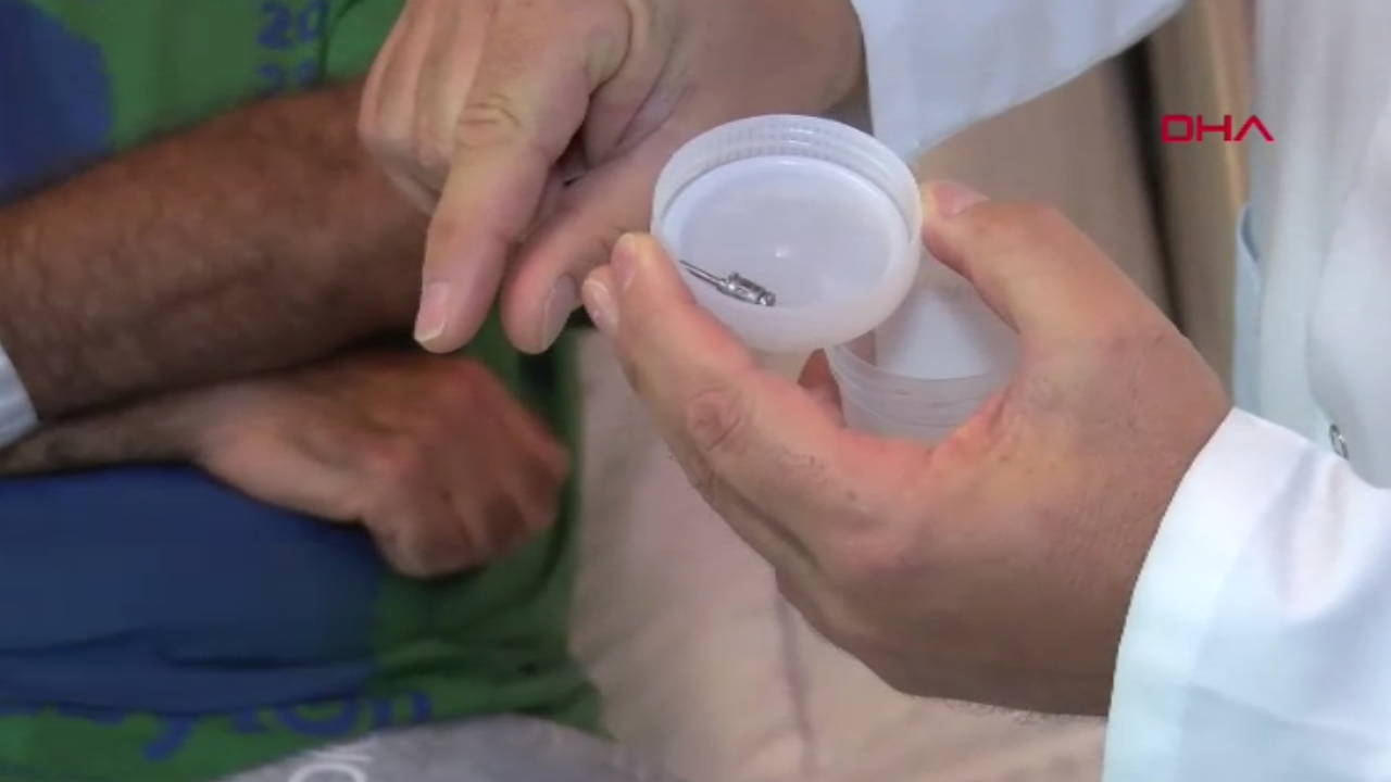 Öksürük şikayetiyle gitti: Akciğerinden diş implantı çıktı