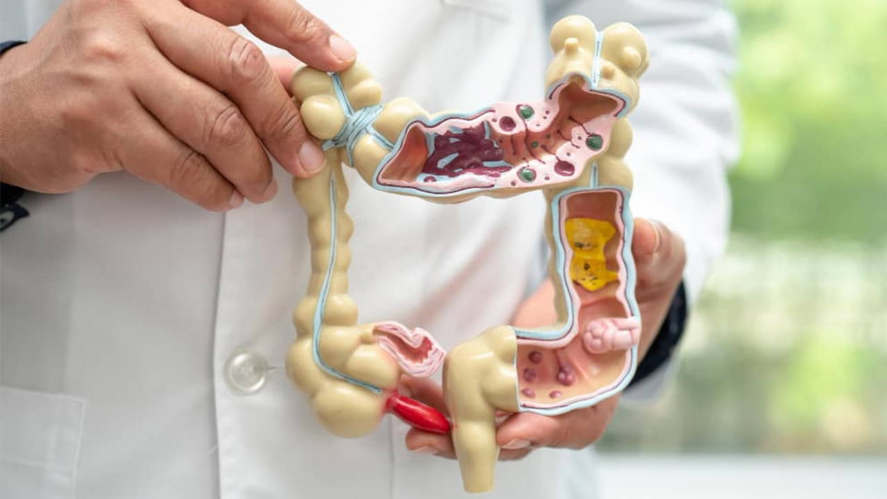 Bağırsağınıza iyi bakmanın 5 altın kuralı: Uzmanlar bu maddelerden kaçının diyor!