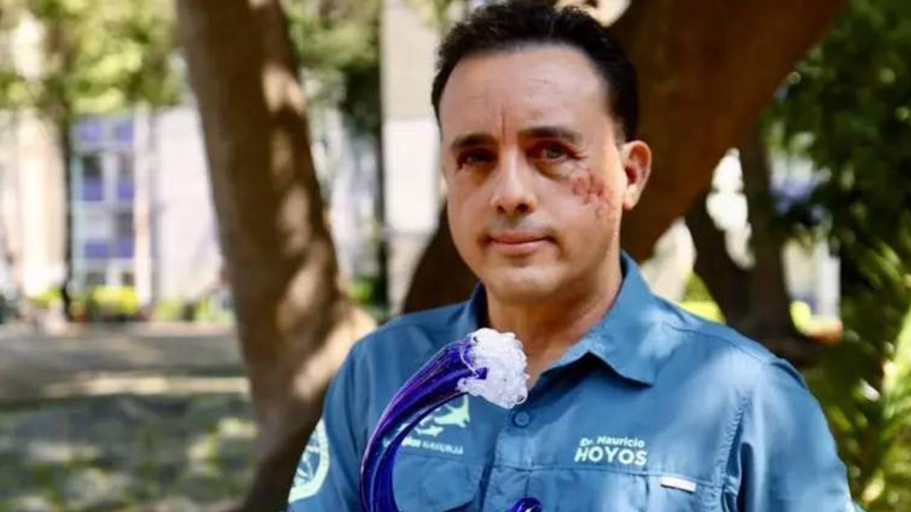 Köpekbalığı başından ısırdı, sağ kaldı: 'Bu hayvan hayatımı bağışladı'