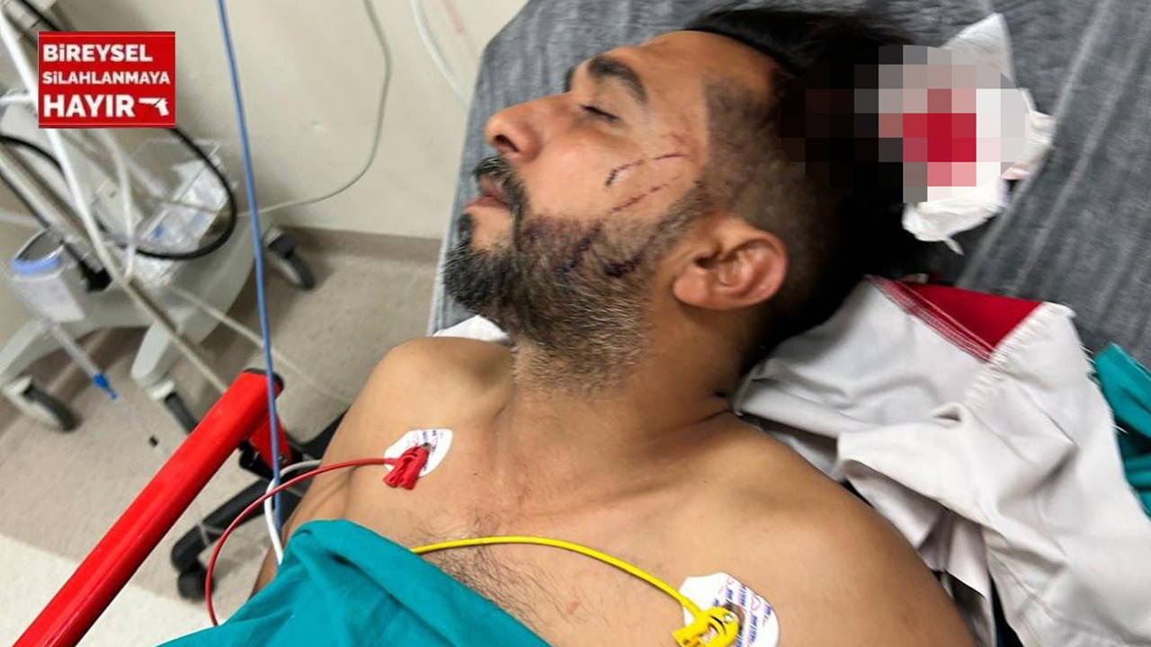 Dönercide dürüm yerken başından vuruldu: Durumu ağır