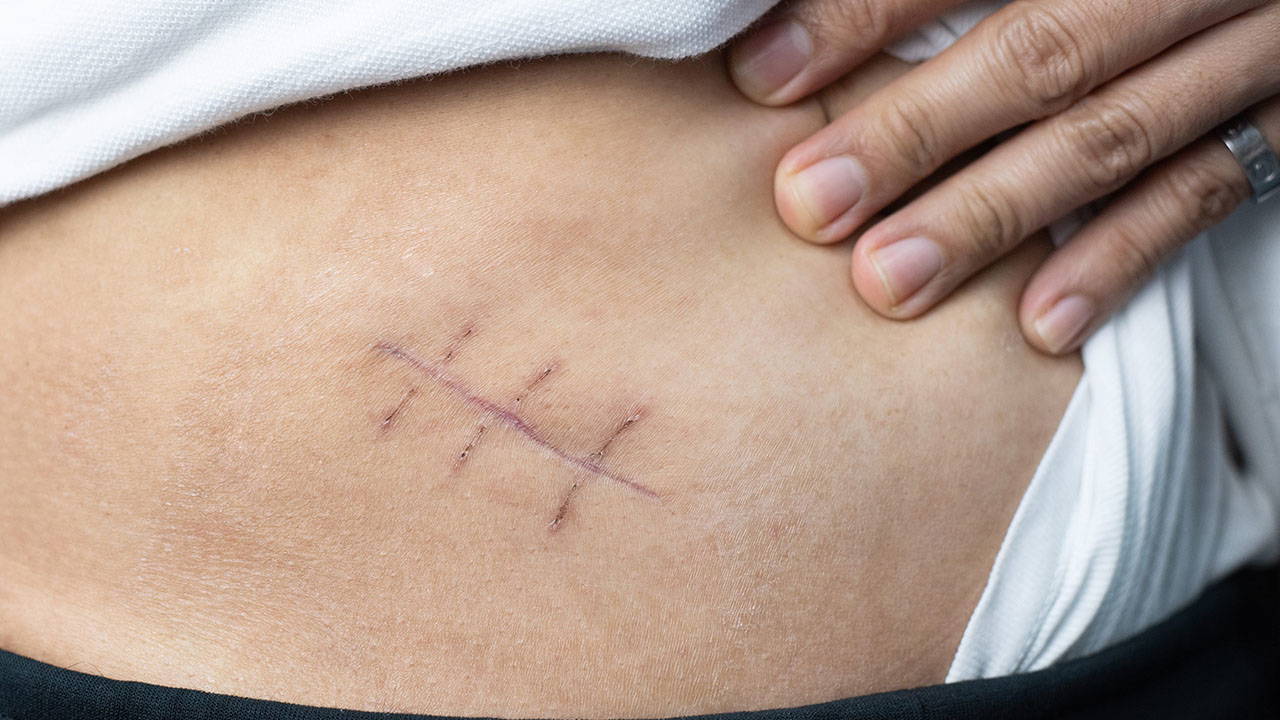 Aynı gün taburcu olma imkanı: Kadın hastalıklarında 'izsiz' ameliyat dönemi