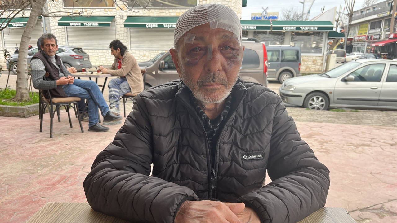 Önce çakmak istediler ardından sokak ortasında darbettiler