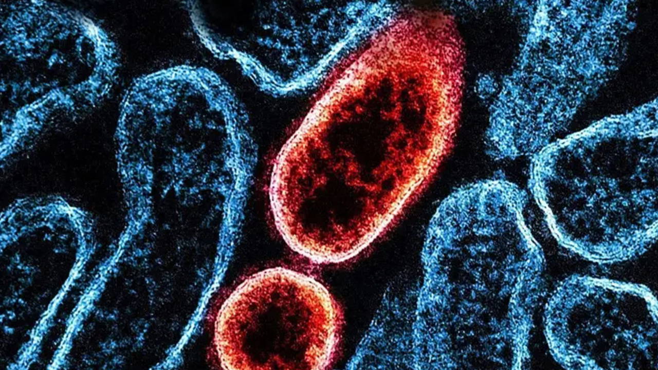 Nipah virüsü nedir, nasıl yayılıyor, ne kadar tehlikeli?