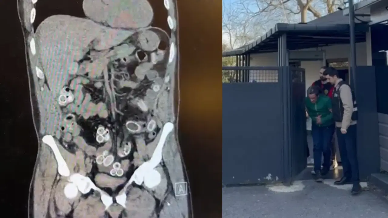 Ameliyatla çıkarıldı! Fas’tan Beşiktaş'a midesinde 'uyuşturucu' ile geldi