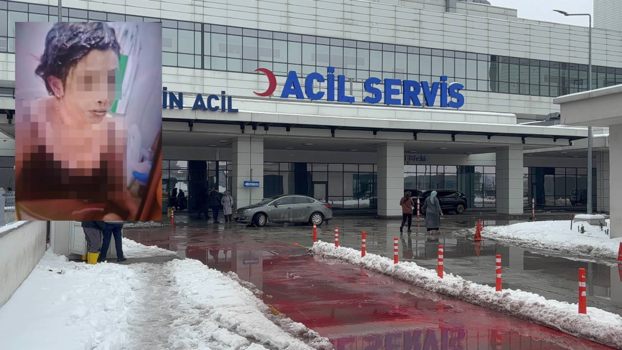 Erkek vahşeti bitmiyor... Bağlayıp başından aşağı kezzap döktü!