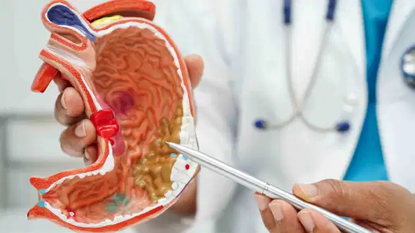 Reflü şikâyetini göz ardı etmeyin: Mide fıtığı habercisi olabilir!