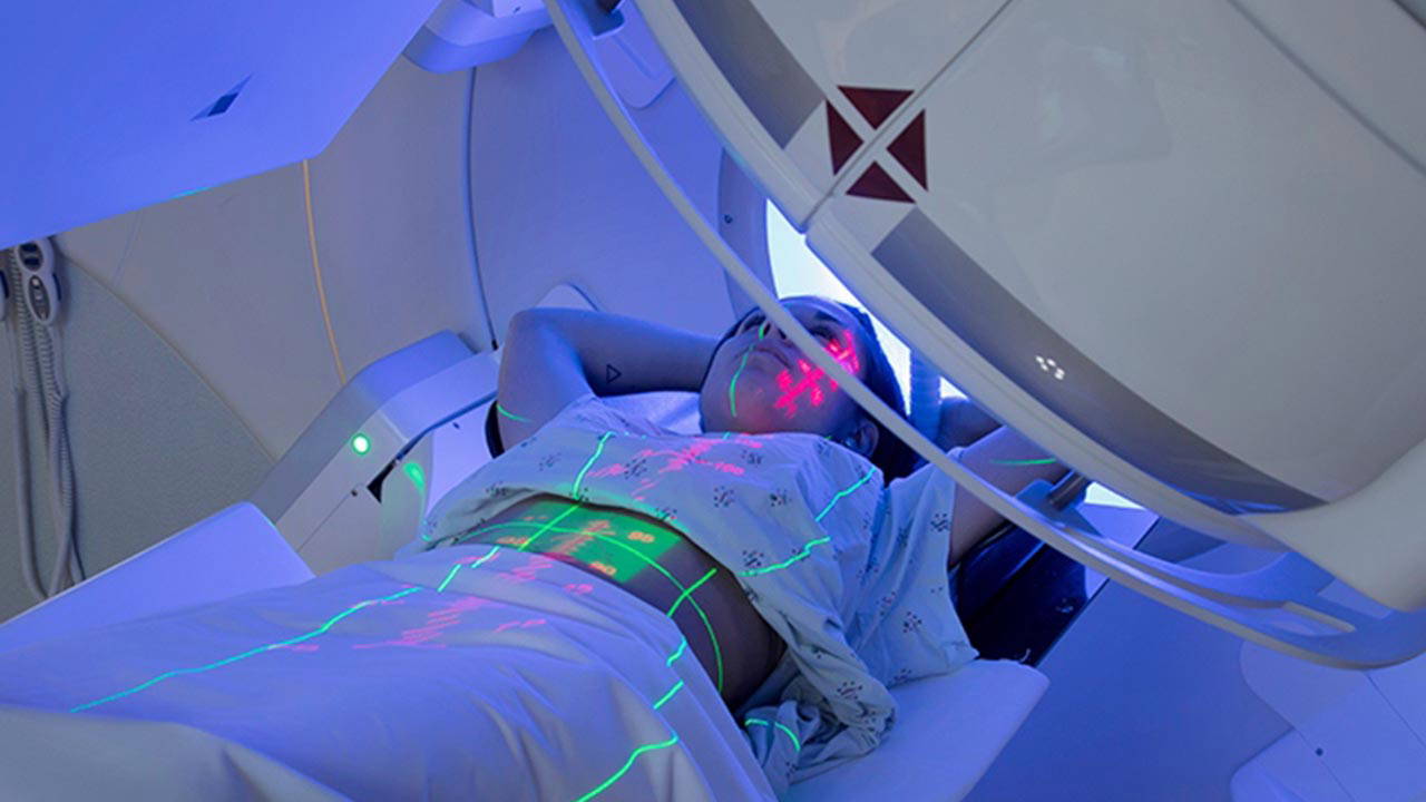 Radyoterapi hakkında doğru bilinen yanlışlar