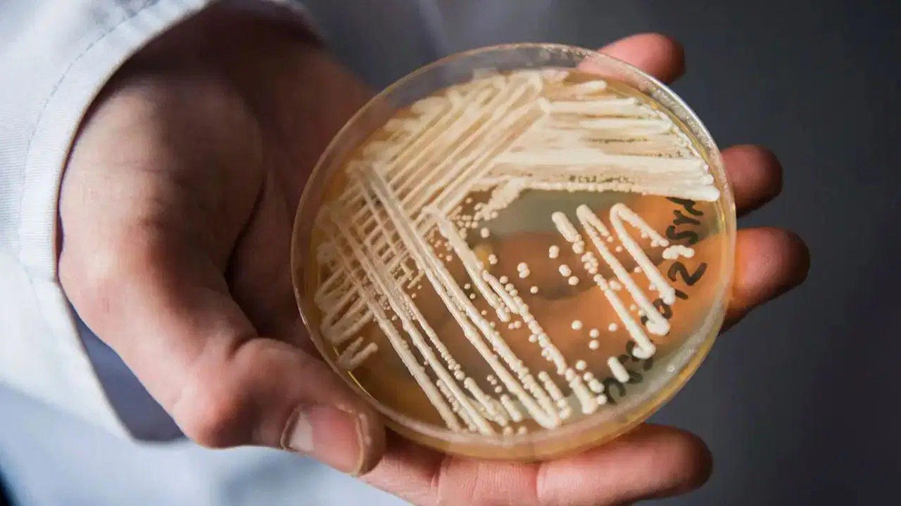 İlaçlara dirençli ölümcül mantar dünyaya yayılıyor