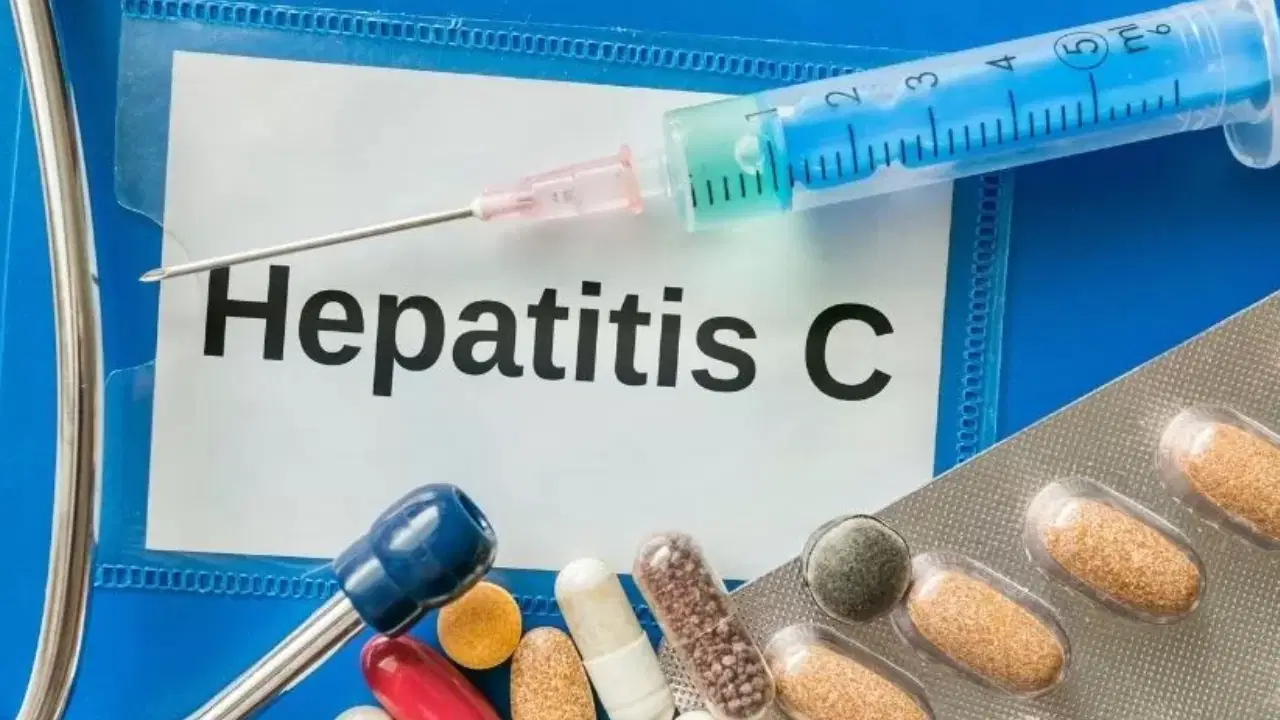 Hepatit C sessiz ilerliyor: 15–20 yılda kansere dönüşebiliyor!