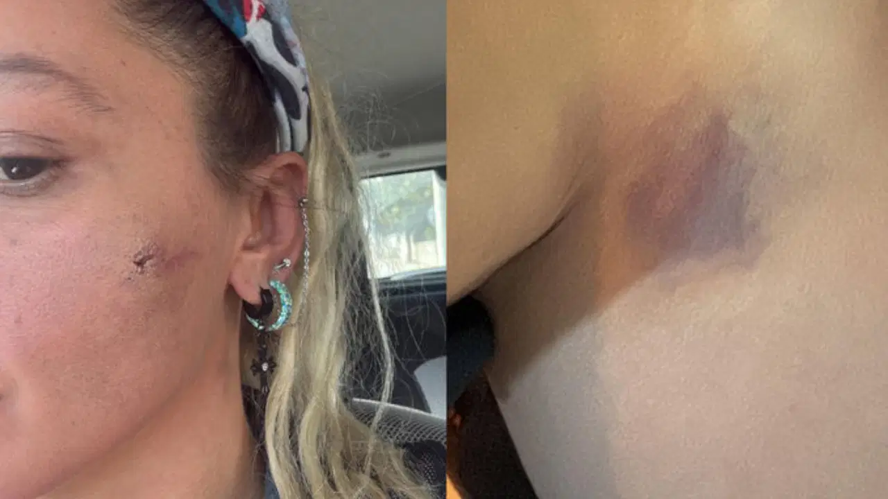 Yıldız Asyalı eşinden şiddet gördüğünü açıkladı