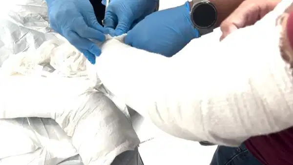 Kolundaki alçıda 1 kilo uyuşturucuyla yakalandı: Tutuklandı