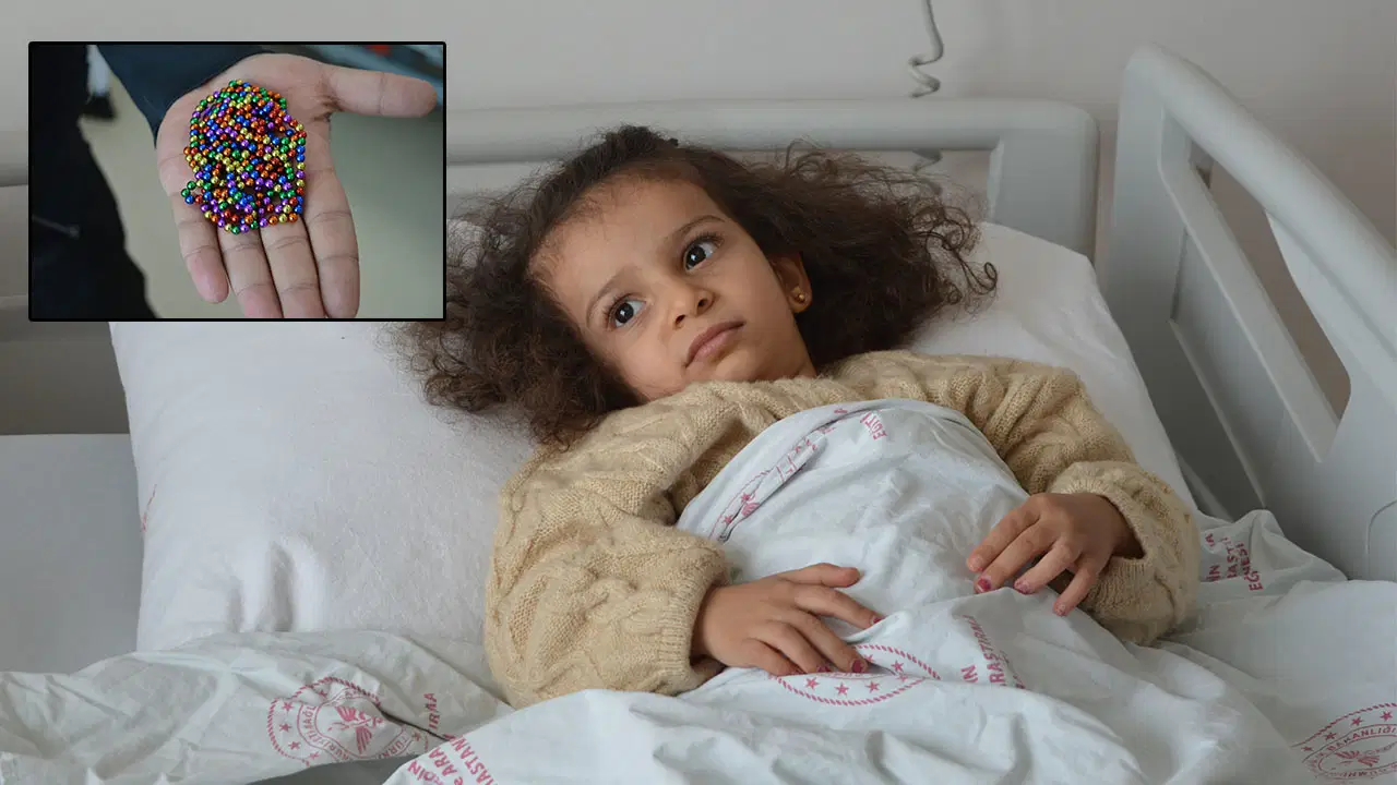 Doktorları şoke eden olay: 4 yaşındaki Eda'nın bağırsağından 8 mıknatıslı boncuk çıktı!